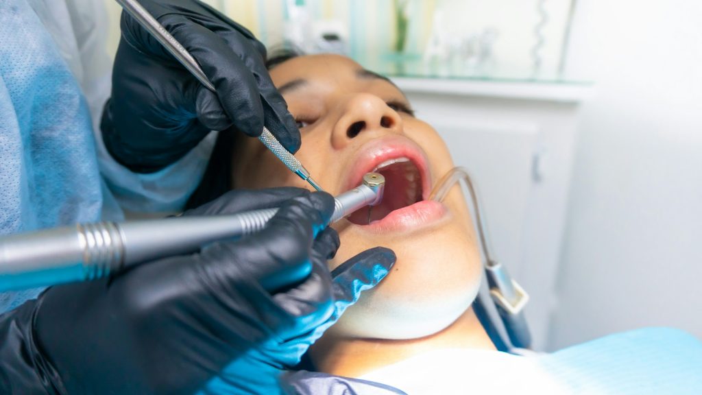 dental crown bridge restoration teeth model