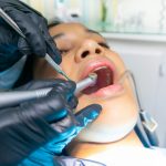 dental crown bridge restoration teeth model